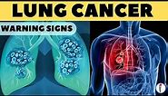 Lung Cancer Warning Signs II Lung Cancer Symptoms