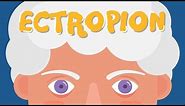 What is Ectropion?
