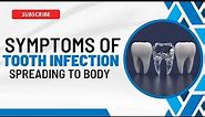 Tooth Infection Spreads: Recognizing the Symptoms and What to Do