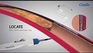OUTBACK™ Elite Re-Entry Catheter Product Highlights