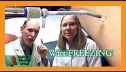 Wart Freezing | Auburn Medical Group