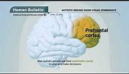 Science Bulletins: Autistic Brains Show Visual Dominance
