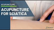 Acupuncture for sciatica pain