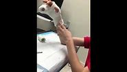 Broken finger cast /3