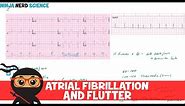 Rate and Rhythm | Atrial Fibrillation and Atrial Flutter