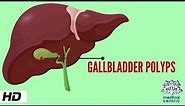 Gallbladder Polyp, Causes, Signs and Symptoms, Diagnosis and Treatment.
