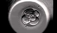 ivf embryo developing over 5 days by fertility Dr Raewyn Teirney