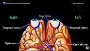 VISUAL PATHWAY ANIMATED - Animated anatomy lectures USMLE Step 1