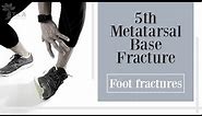 5th Metatarsal Base Fracture - foot fracture
