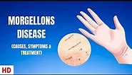 Morgellons Disease (Causes, Symptoms and Treatment)