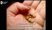 Is kidney stone surgery life threatening What size of kidney stone requires surgery? -Dr. Manohar T