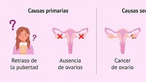 ¿Cómo es la menstruación irregular y cuáles son sus causas?