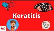 Keratitis, Causes, Signs and Symptoms, Diagnosis and Treatment.