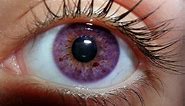 7 Rarest and Unusual Eye Colors That Looks Unreal