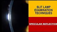 SPECULAR REFLECTION in SLIT LAMP | All you need to know
