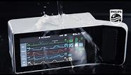 Philips IntelliVue X3 rugged patient monitor withstands transport challenges