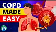 COPD Explained - Types, Causes, Symptoms, and Treatment ❗