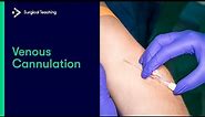 Intravenous (IV) Cannulation | An Essential Guide