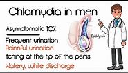 Chlamydia in men: Pictures, treatment, causes, symptoms, signs, discharge, cure