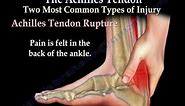 Achilles Tendon rupture ,tear, tendonitis - Everything You Need To Know - Dr. Nabil Ebraheim
