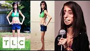 Body Bizarre | The World's Thinnest Woman