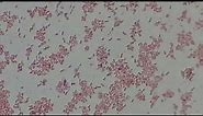 Klebsiella pneumoniae Gram stained Footages under the Microscope/ Gram Negative Bacteria