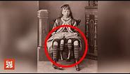 25 STRANGE Birth Defects Few Kids Are Born With