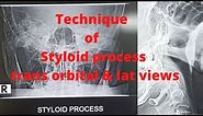Technique of styloid process(Ep-34) |Styloid trans orbital view & lateral view I Tutorial .