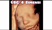 USG Kehamilan 4 Dimensi Full Version / Pregnancy Video Ultrasound