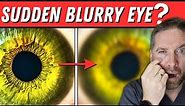Sudden Blurry Vision In One Eye?! (5 Causes)