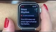 Check ECG on Apple Watch