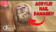 ACRYLIC NAILS GONE BAD! Why you shouldn’t get these!