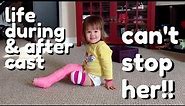 Toddler Broken Leg, Cast, & Recovery (cute 7 week summary)