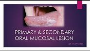 Primary & Secondary Oral Mucosal Lesion