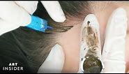 Hairline Microblading Gives The Appearance of Fuller Hair