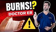 HOW TO TREAT A BURN — ER Doctor Explains Treating Burns, Blisters, Classifications, & Degrees