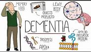 Understanding Dementia (Alzheimer's & Vascular & Frontotemporal & Lewy Body Dementia)