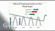 Basal/Bolus insulin and Carbohydrates
