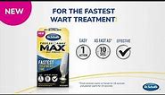Dr Scholl's | How to Use Freeze Away Max™ Wart Remover