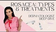 Rosacea: Types, Treatments & Tips | Dermatologist Deep Dive