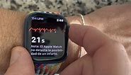 AFib (Atrial Fibrillation) EKG/ECG on Apple Watch