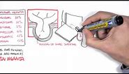 Introduction to Direct and Indirect Inguinal Hernia