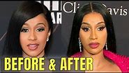 Cardi B: Plastic and Cosmetic Surgery