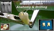 Third Molar (Wisdom Tooth) Anatomy & Drilling