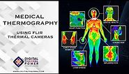 Medical Thermography using FLIR Thermal Camera