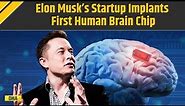 Elon Musk's Neuralink Implants Wireless Brain Chip In First Human Patient