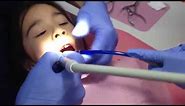 5 minutes Space-Maintainer By Dr. Idlibi, Kids Dental Care