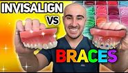 Braces vs Invisalign: Cost, Tooth Pain, Speed, etc - The ULTIMATE Review 🔥