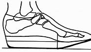 Rocker Bottom Shoes | Foot & Ankle