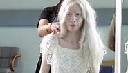 Woman with albinism adds color to hair, eyes, and skin